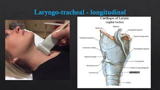 Neck US  Basic Anatomy [upl. by Cartie]