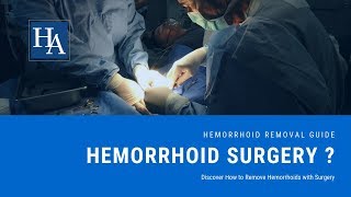 Discover How to Remove Hemorrhoids with Surgery  Hemorrhoid Removal Guide [upl. by Nessim]