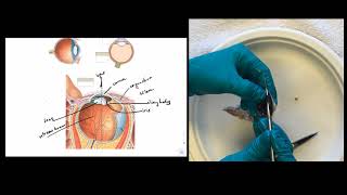 Eye Dissection Instructions [upl. by Ellac]