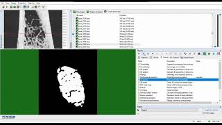 Automated segmentation of trabecular and cortical bone  CTAn  MicroCT [upl. by Turpin]