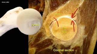 Fascia of the neck anatomy [upl. by Aldric]