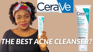 Cerave Acne Foaming Cream Cleanser Review  Dr Janet [upl. by Eanram]