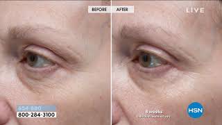 StriVectin Intensive Eye Concentrate for Wrinkles [upl. by Lustick]