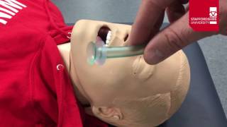 Nasopharyngeal Airway Insertion [upl. by Loella230]